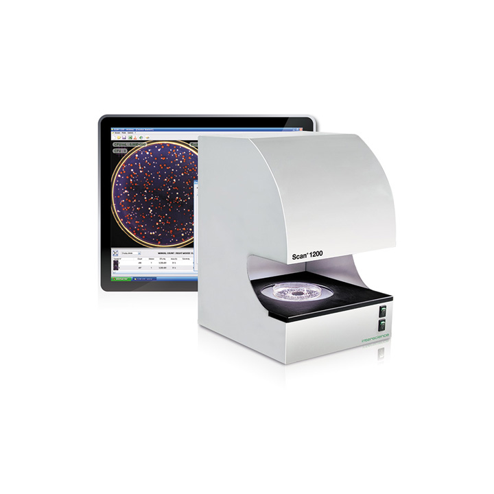 Automata telepszámlálás– Scan 1200 teljesítményértékelés